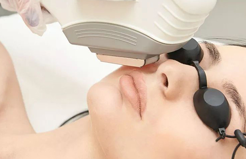 Laser Hair Removal After