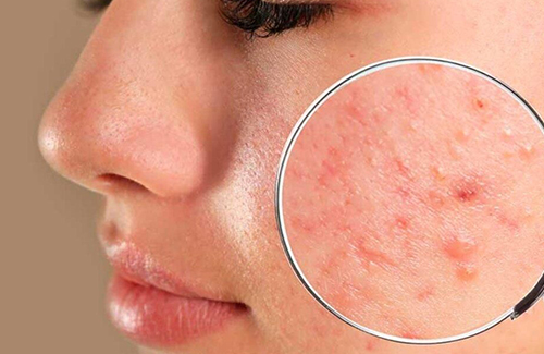 Sea Moss Skincare