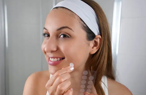 Pimple Patch Treatment