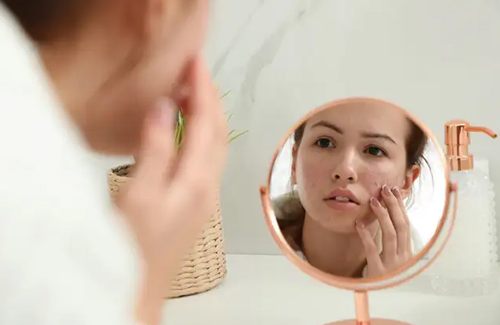 Using Acne Patches