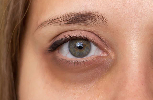 Vitamin C for Skin