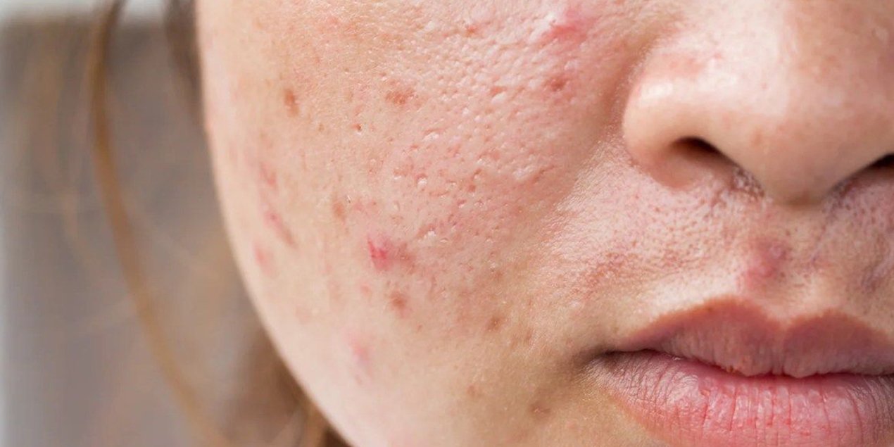 Is Sea Moss Good for the Skin? - The Skin Sensé Blog