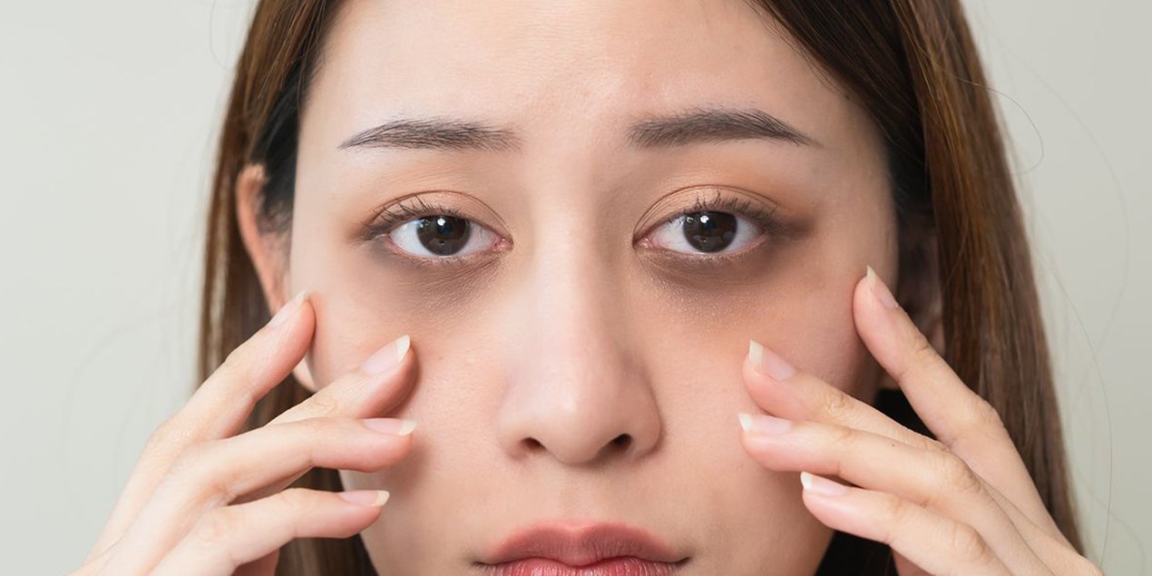 Reduce Dark Circles & Brighten Skin with Vitamin C - The Skin Sensé Blog